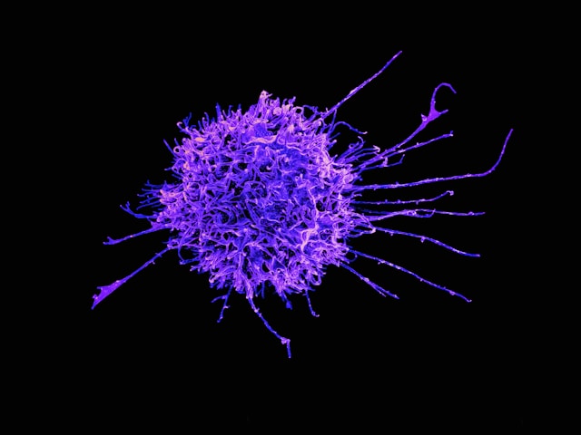 How to Strengthen Your Immune System for the School Season